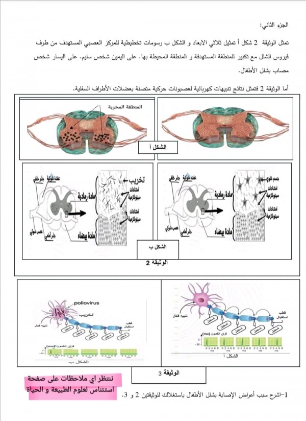 تمرين فيروس شلل الأطفال مع الحل سنة أولى ثانوي وضعية حول شلل الأطفال